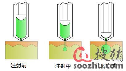 獸用無針注射器 現(xiàn)代化獸醫(yī)醫(yī)療器械的創(chuàng)新與優(yōu)勢